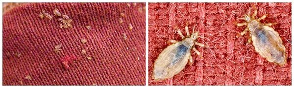 Платяная вошь как выглядят Могут ли вши жить в подушках и на диване, сколько живут и способы уничтожения