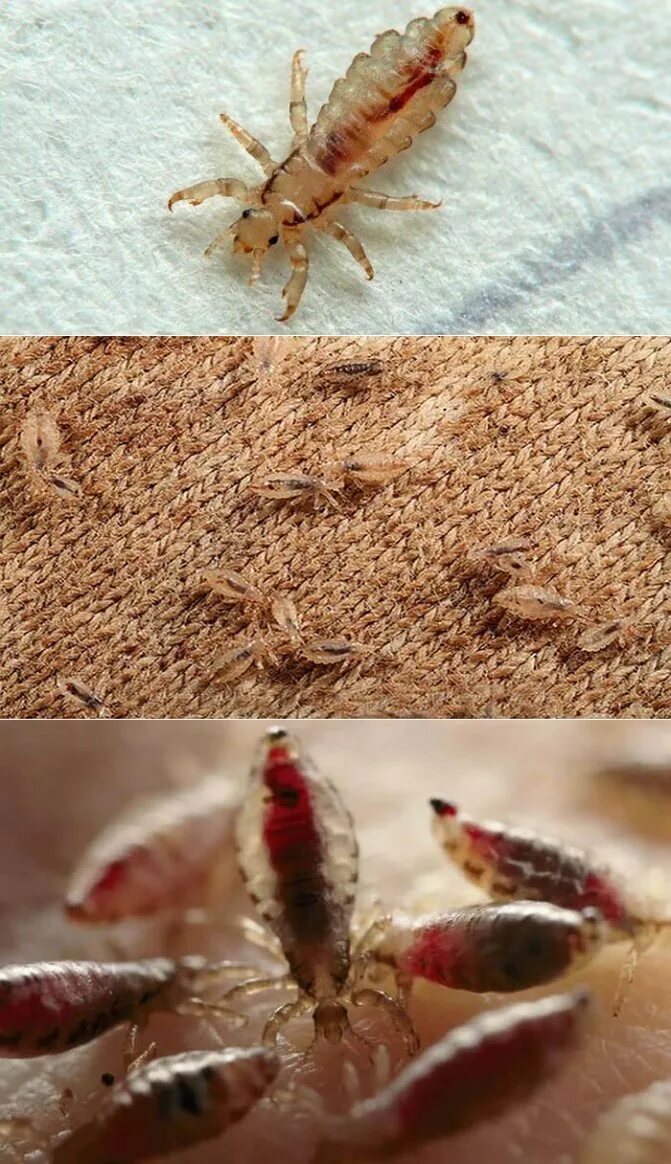 Платяная вошь как выглядят Клопы и вши в постельном белье: как отличить?