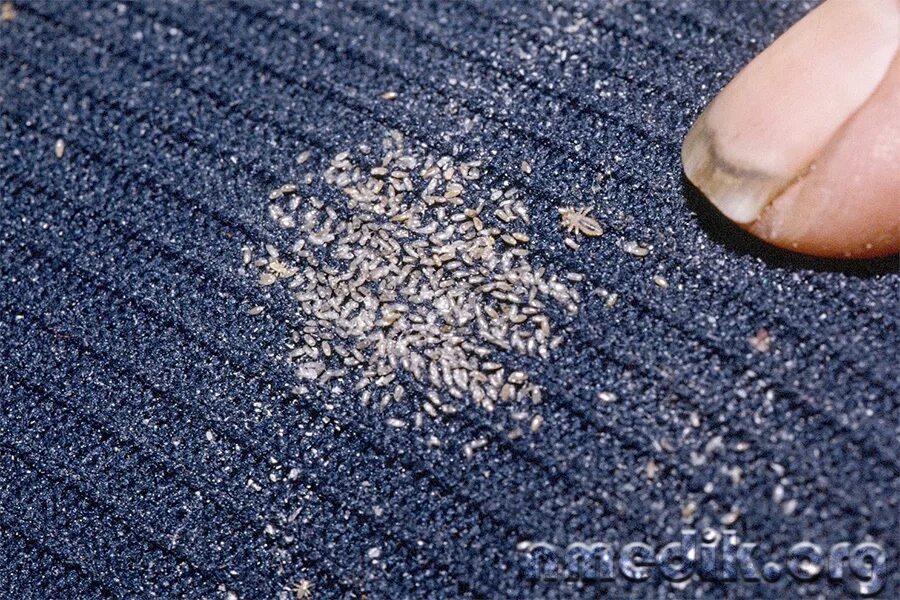 Платяная вошь как выглядят Что такое педикулез и как его вылечить nmedik.org