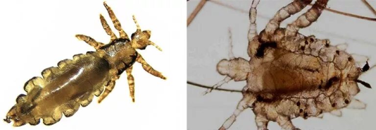 Платяная вошь как выглядят Вша платяная фото: найдено 88 изображений