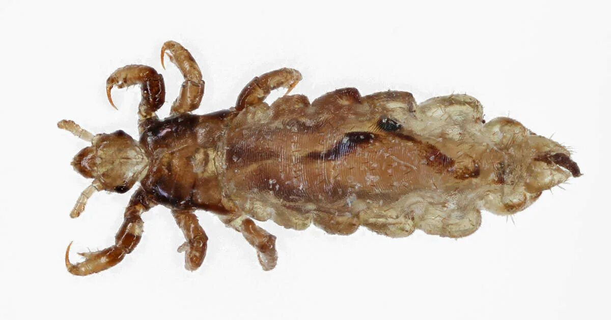 Платяная вша как выглядит Q&A: Is B. quintana a neglected tropical disease?