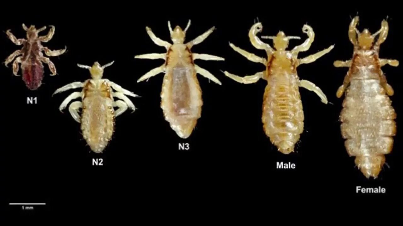 Платяная вша как выглядит 10 Head Lice Removal Facts & Tips! Bizarre Lice Stats - YouTube