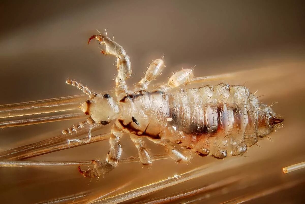 Платяная вша как выглядит фото ВШИ могут поражать людей, проживающих даже в благополучных условиях - Сахалински