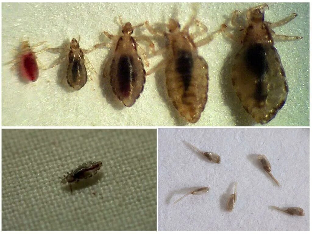 Платяная вша как выглядит фото Откуда берутся и как вывести постельных вшей - обзор лучших методов борьбы с пар