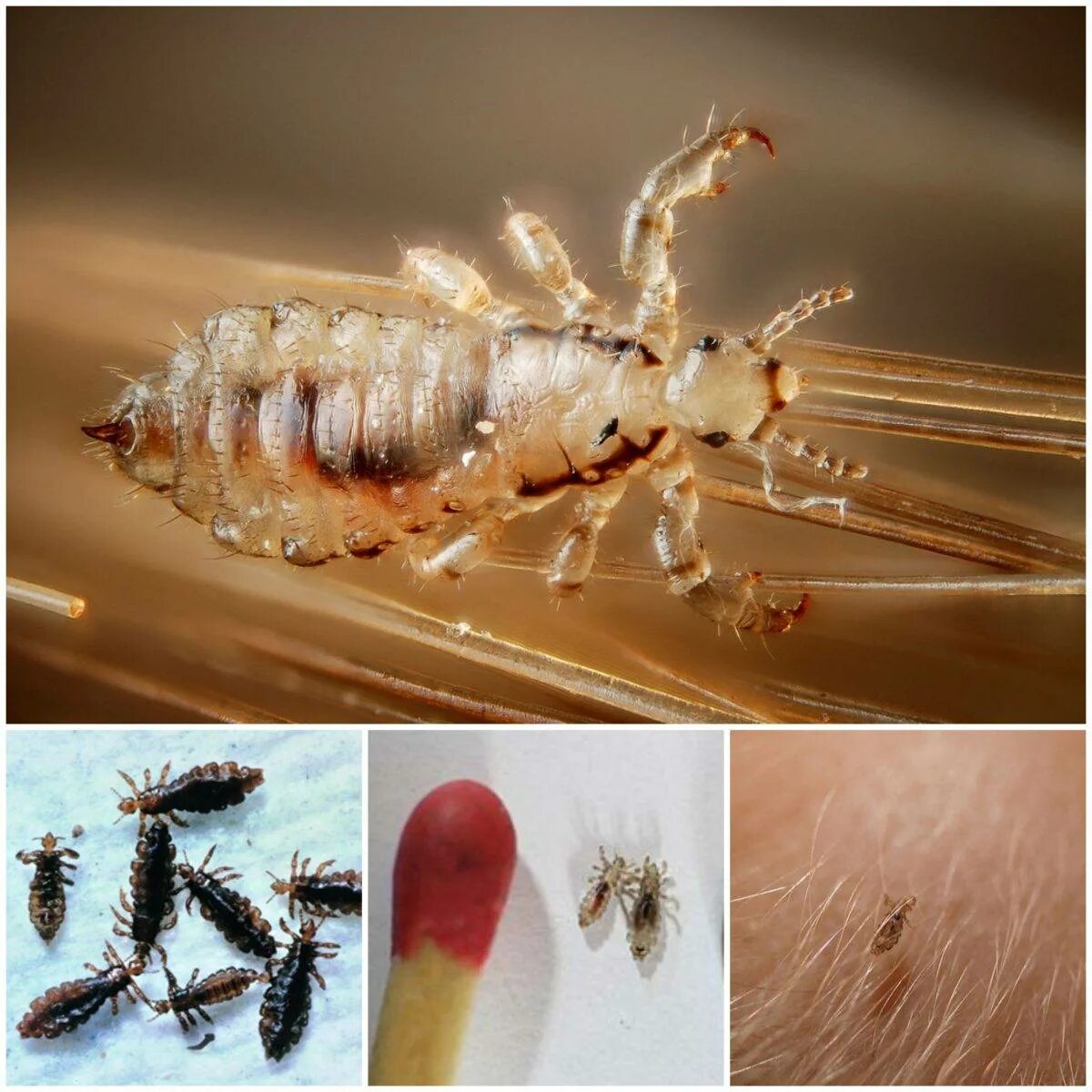 Платяная вша как выглядит фото Вши на окрашенных