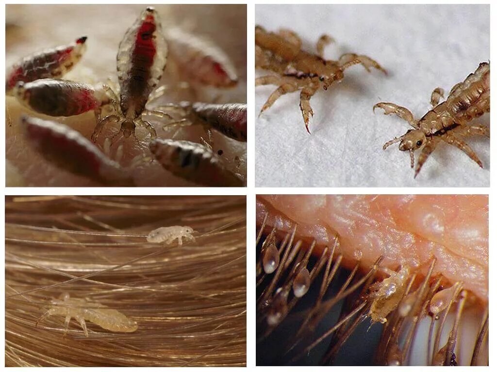 Платяная вша как выглядит фото Почему вшей назвали вшами