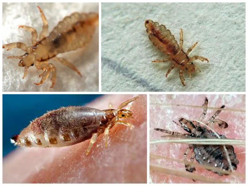 Платяная вша как выглядит фото Как эффективно избавиться от бельевых вшей в домашних условиях - Uborka.co