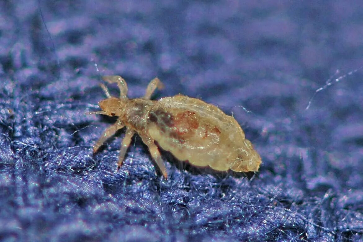 Платяная вша как выглядит фото О чём поведала вша? Василий Елизаров Дзен