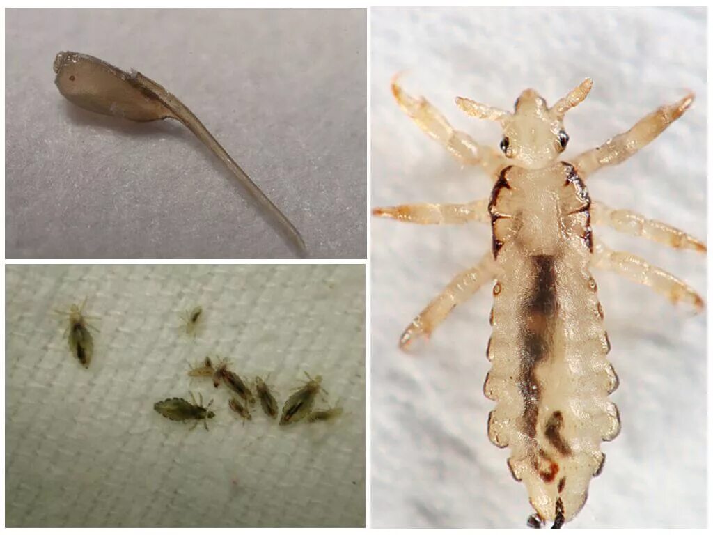 Платяная вша как выглядит фото Откуда берутся и как вывести постельных вшей - обзор лучших методов борьбы с пар