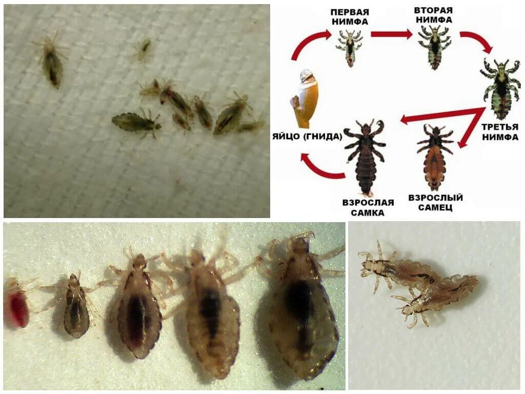 Платяная вша как выглядит фото Уничтожение бельевых вшей в квартире в Костроме - Избавиться от платяных (бельев