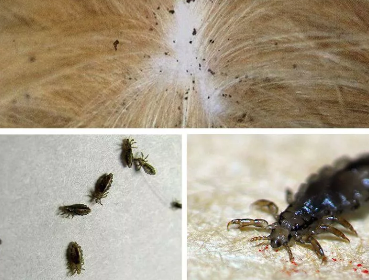 Платяная вша как выглядит фото Ответы Mail.ru: это вши или нет? я расчесывал волосы над листом бумаги и на лист