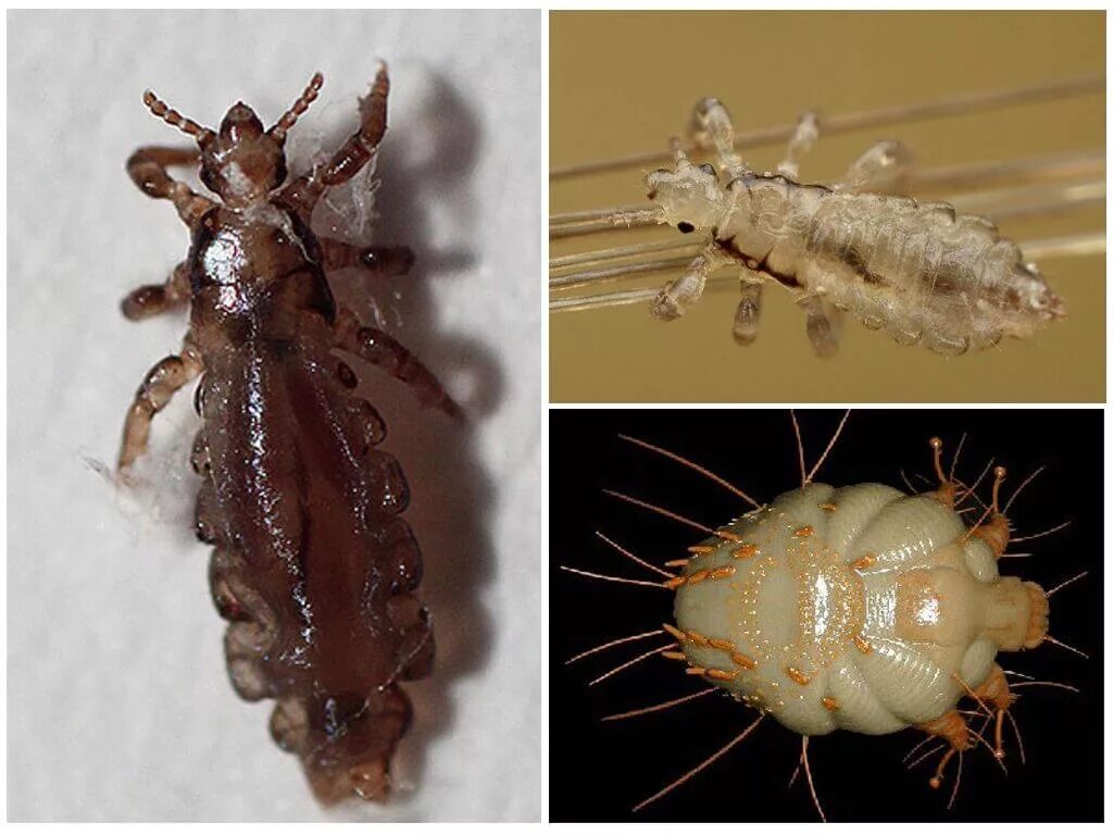 Платяная вша как выглядит фото Платяная вошь: фото, описание, как избавиться в домашних условиях