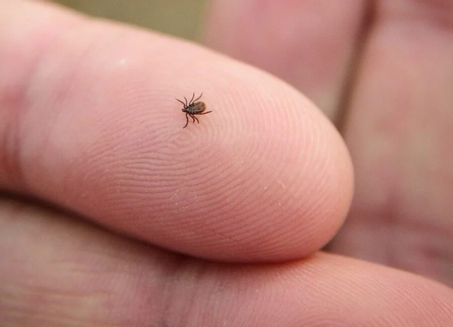 Платяной клещ фото Перечень медицинских организаций, извлекающих клеща в случае его присасывания и 