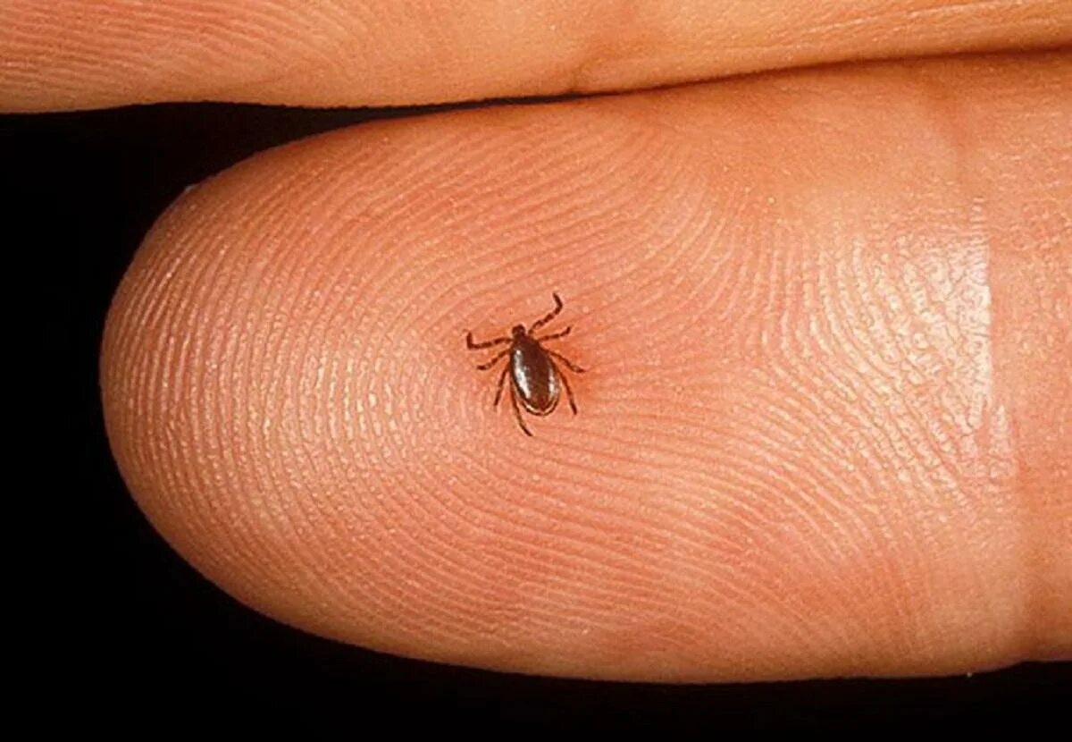 Платяной клещ фото The doctor explained, what consequences for mentality the sting of a tick can ca