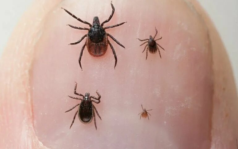 Платяной клещ как выглядит С начала эпидсезона от клещей в Хакасии пострадали почти 500 человек Медиагруппа