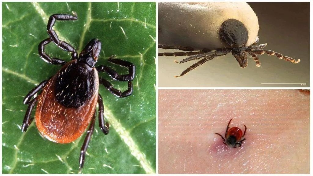 Платяной клещ укусы фото Роспотребнадзор контролирует эпидемиологическую ситуацию по инфекциям, передающи