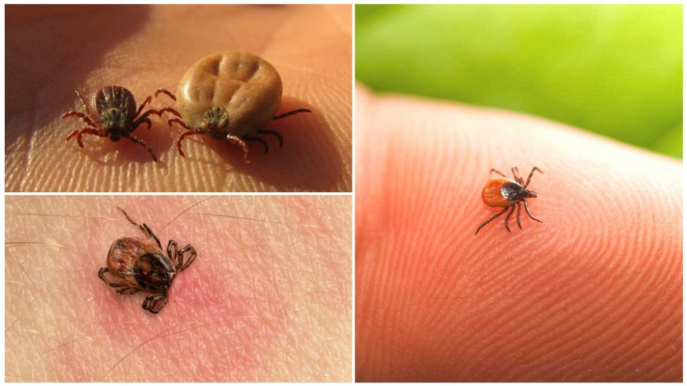 Платяной клещ укусы фото Забудьте про олію: як швидко і правильно вийняти клiща