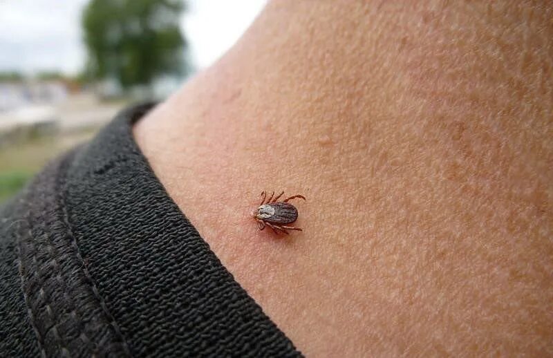 Платяной клещ укусы фото ЧТО ДЕЛАТЬ, ЕСЛИ УКУСИЛ КЛЕЩ? - Областная клиническая больница Калининградской о