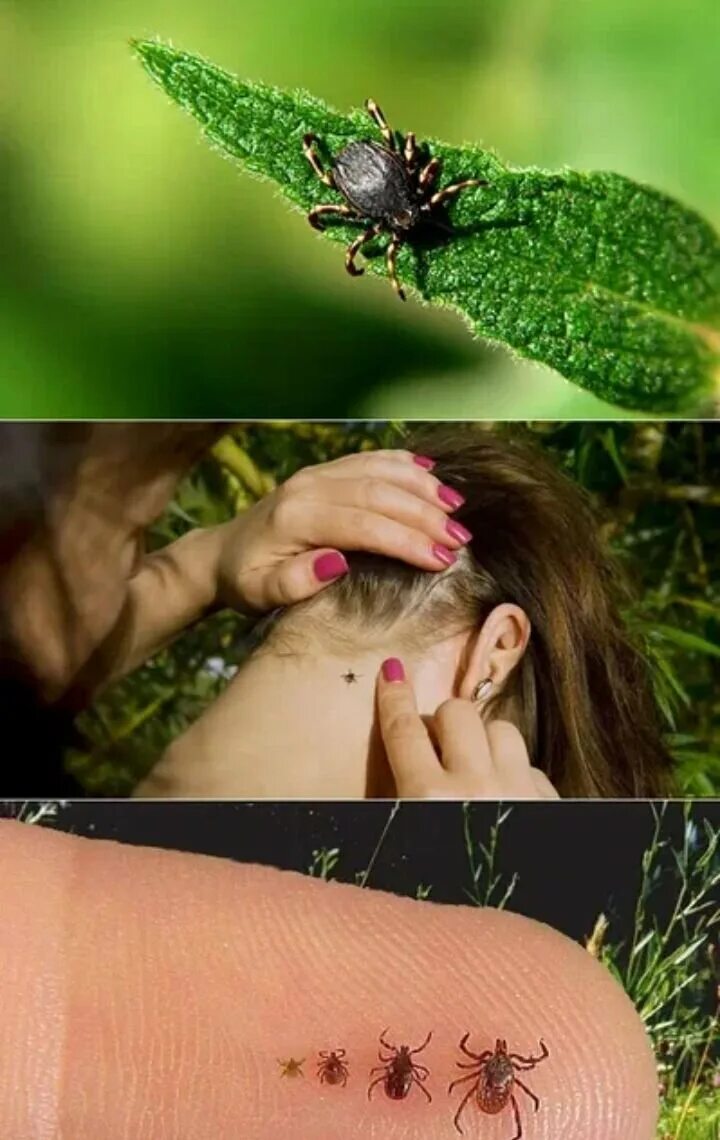 Платяной клещ укусы фото Простой трюк избавит Вас от клещей Плохого не советую Дзен