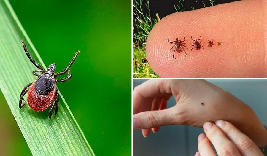 Платяной клещ укусы фото Иксодовые клещи ДГКБ имени З.А. Башляевой