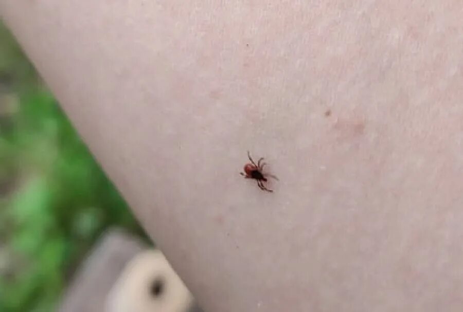 Платяной клещ укусы фото В Усть-Катаве 263 пострадавших от укуса клещами