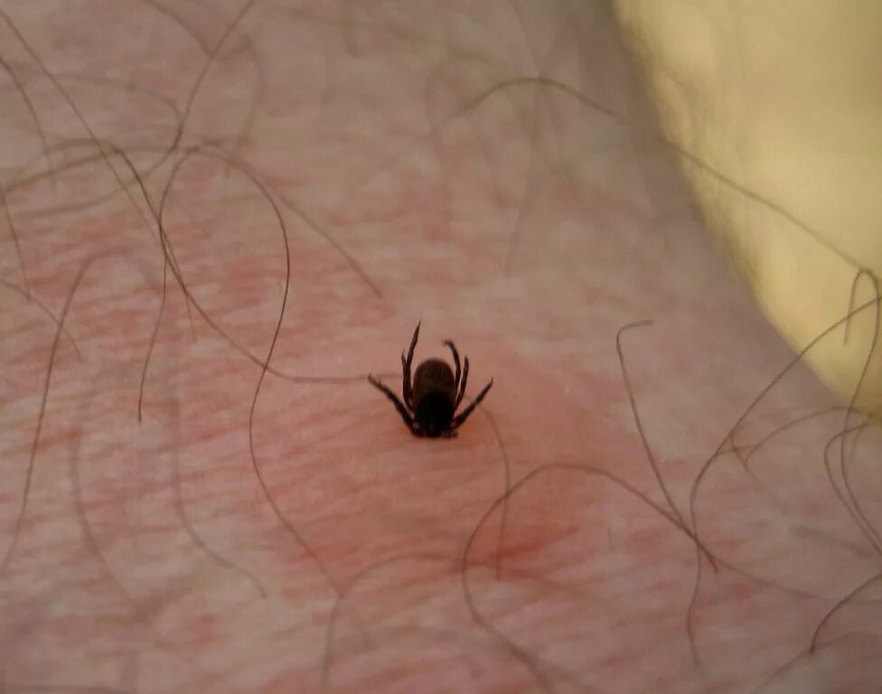 Платяной клещ укусы фото Архив новостей © УДО "Санаторный детский сад № 103"