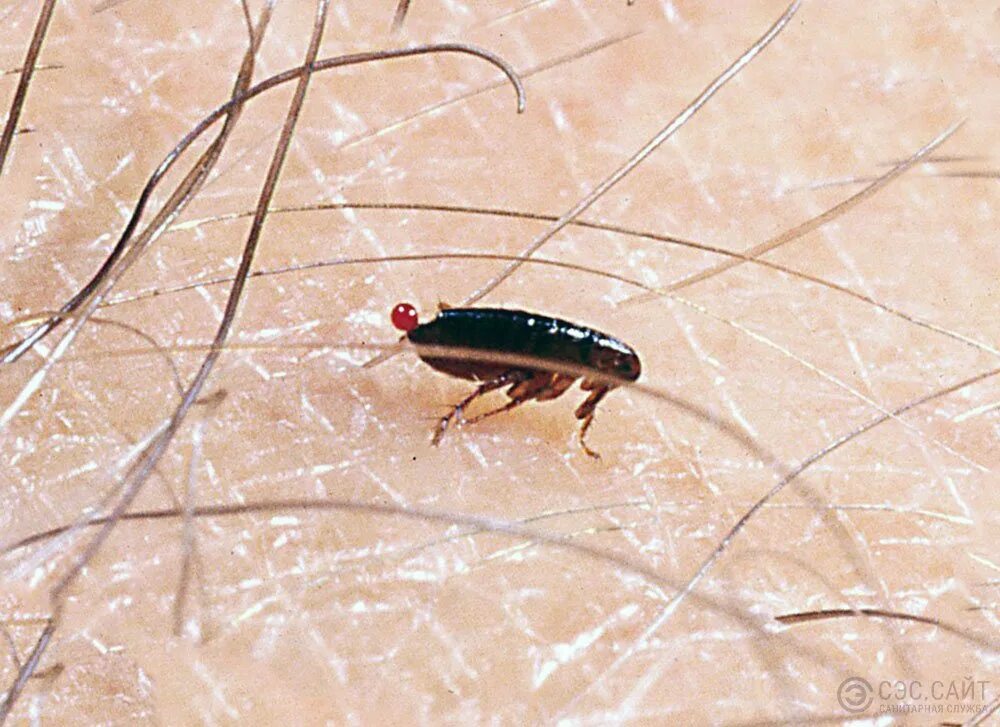 Платяные блохи укусы фото Как выглядит укус блохи: на теле, у ребенка, симптомы, последствия, как лечить, 