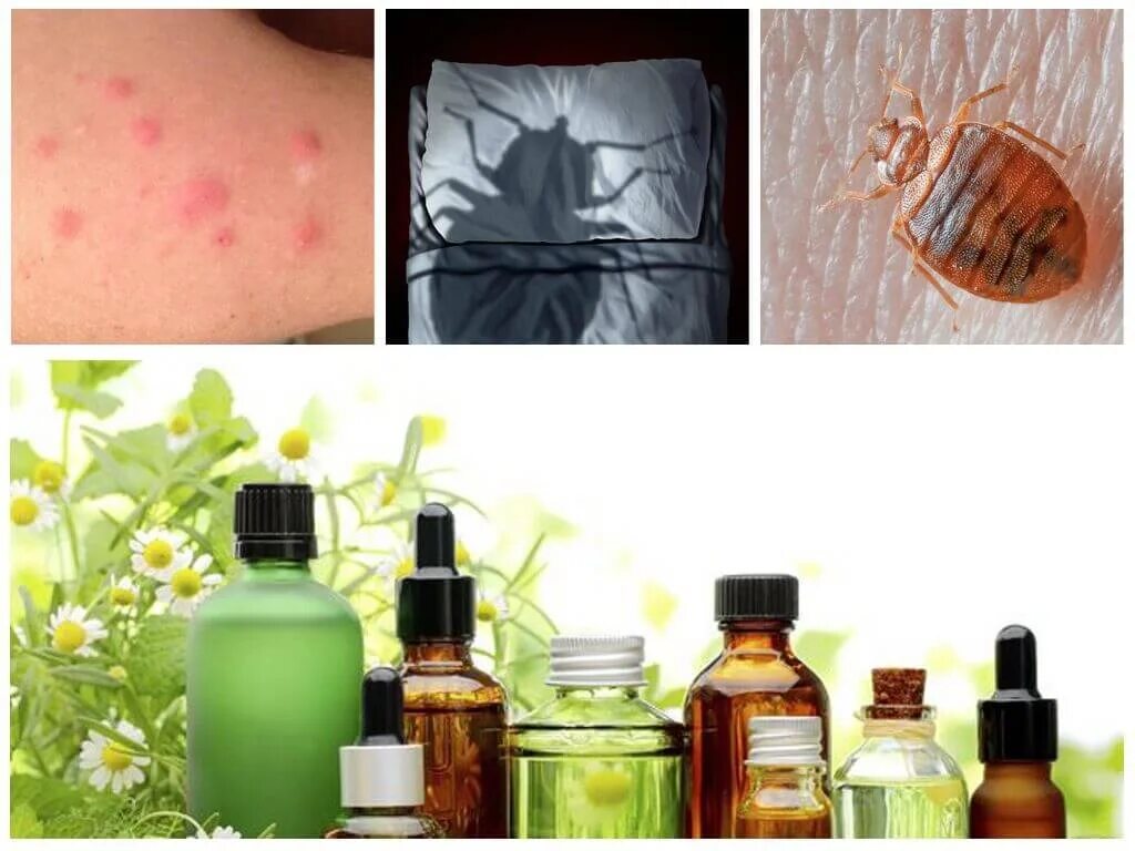 Платяные блохи укусы фото Как лечить укусы клопов. Первая помощь. Лекарства и народные способы! ВКонтакте