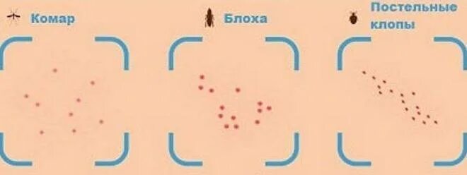 Платяные блохи укусы фото Симптомы укусов блох у детей и способы лечения: обработка кожи, борьба с аллерги