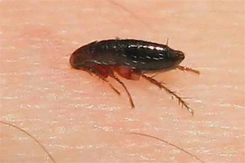 Платяные блохи укусы фото Фото укусов блох на человеке