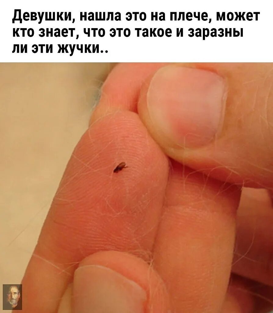 Платяные блохи укусы фото Положи где взяла! Секреты успеха великих людей