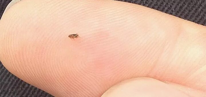 Платяные блохи укусы фото Чем опасны блохи в доме?