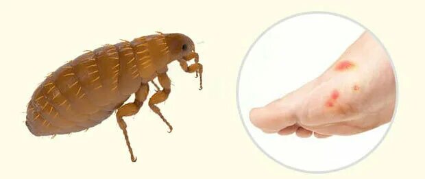 Платяные блохи укусы фото Кто укусил? Слепни, комары, муравьи, вши, блохи, клопы Клиника Ирины Мещериной Д