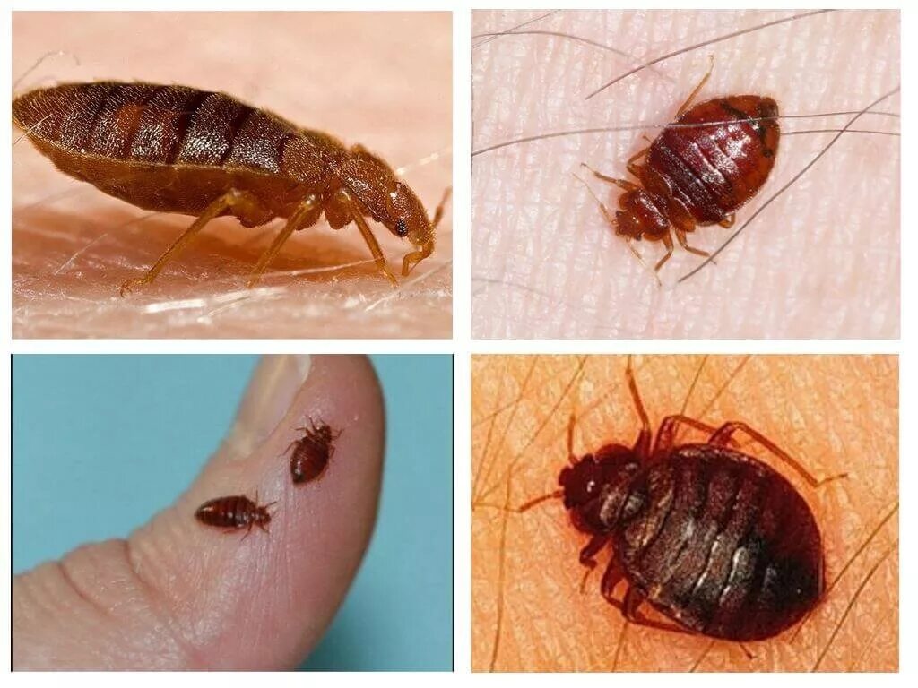 Платяные клопы как выглядят Уничтожение клещей в Еманжелинске: 76 дезинфекторов с отзывами и ценами на Яндек