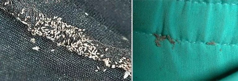 Платяные вши фото укусов Педикулёз: как избавиться от вшей на одежде и постельном белье?