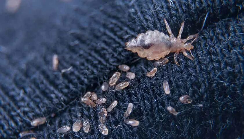 Платяные вши фото укусов Педикулез (вши) - признаки, диагностика и лечение