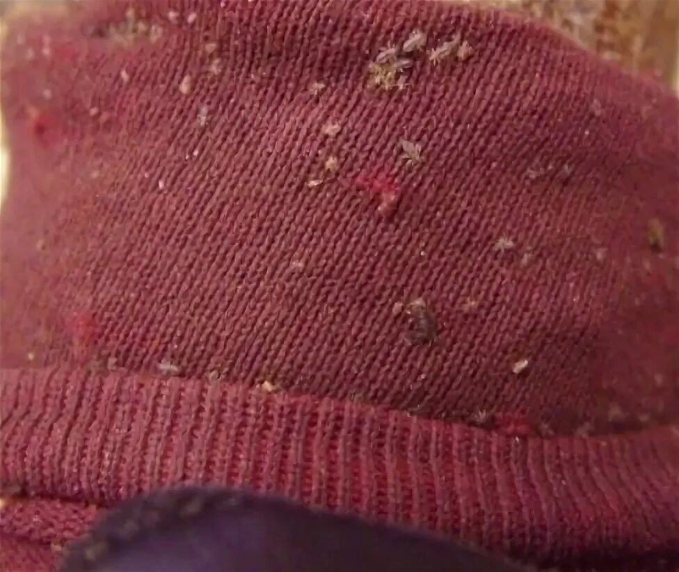 Платяные вши фото укусов Приятно, когда есть рядом такие люди, которым не важно кто ты, по... Интересный 