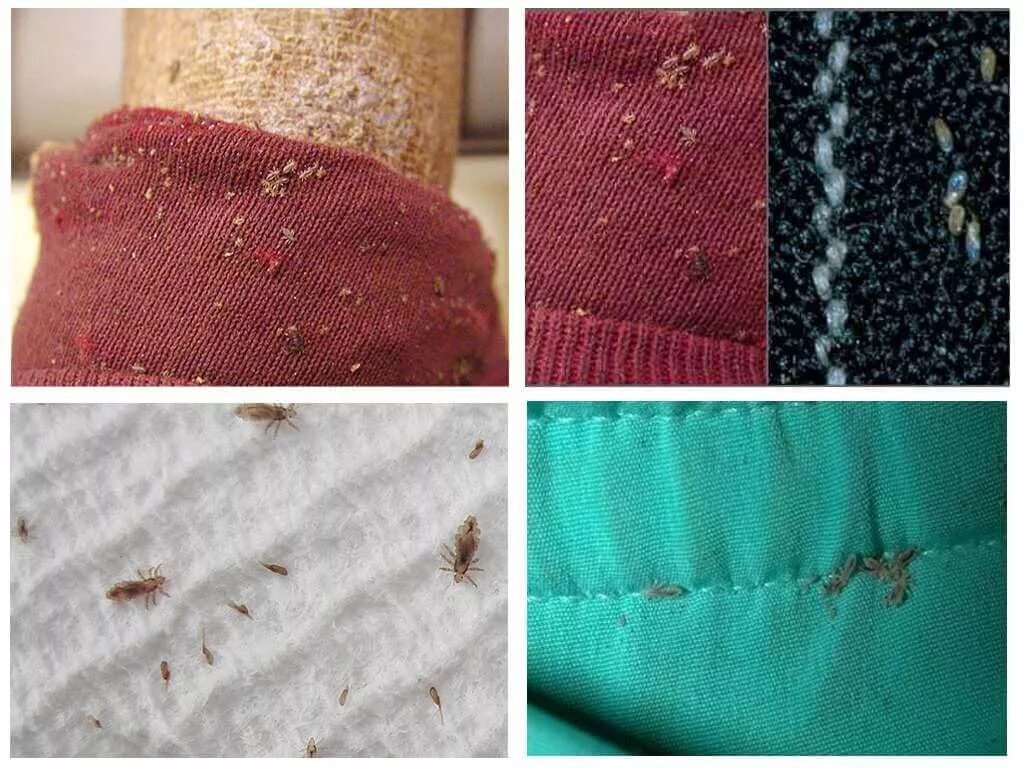 Платяные вши фото укусов на теле Как избавиться от бельевых вшей в квартире