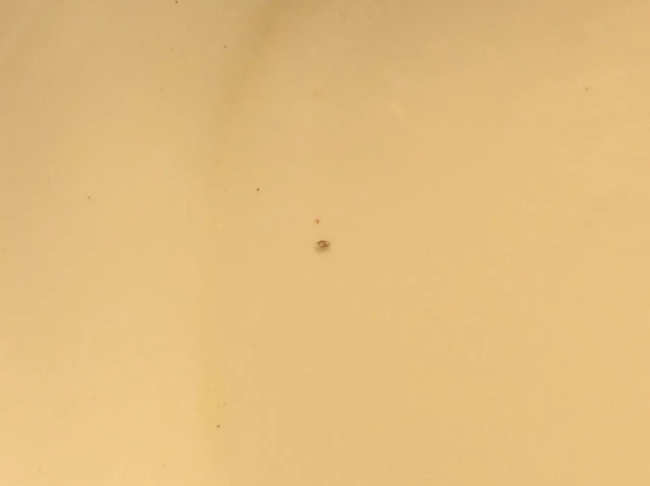 Платяные вши укусы на теле человека фото Лактация, платяные вши - Вопрос дерматологу - 03 Онлайн