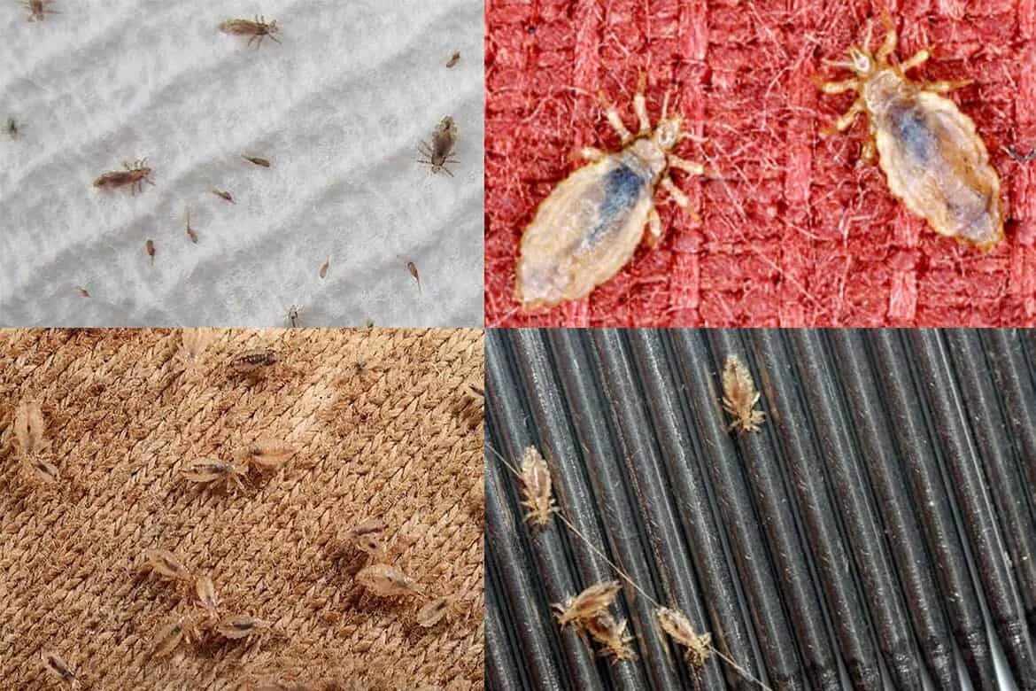 Платяные вши укусы на теле человека фото США, как и назойливая вша! - эксом (Анна Шодик) / Стихи.ру