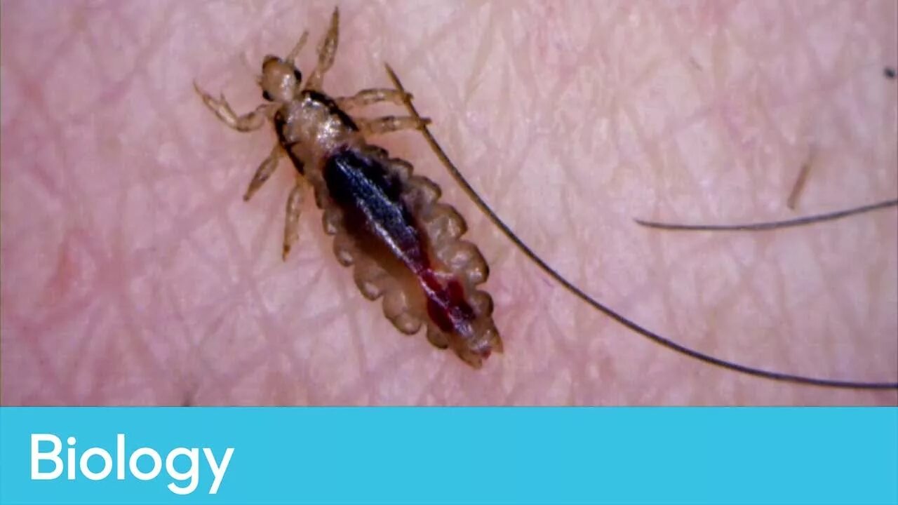 Платяные вши укусы на теле человека фото What the life-cycle of lice tells us about evolution Biology - Infested! Living 