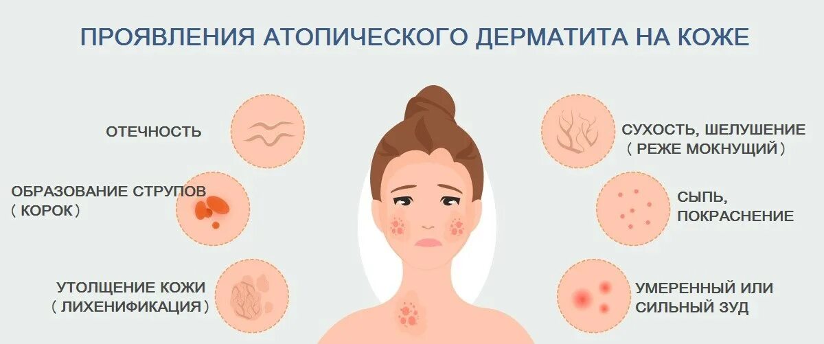 Пленочный дерматит фото Атопический дерматит у взрослых (причины, способы лечения)