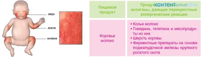 Пленочный дерматит у ребенка на попе фото Маленькие красные прыщики у грудничка на разных частях тела