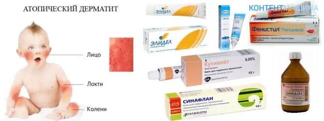 Пленочный дерматит у ребенка на попе фото Опрелости у новорожденных: что делать и чем лечить