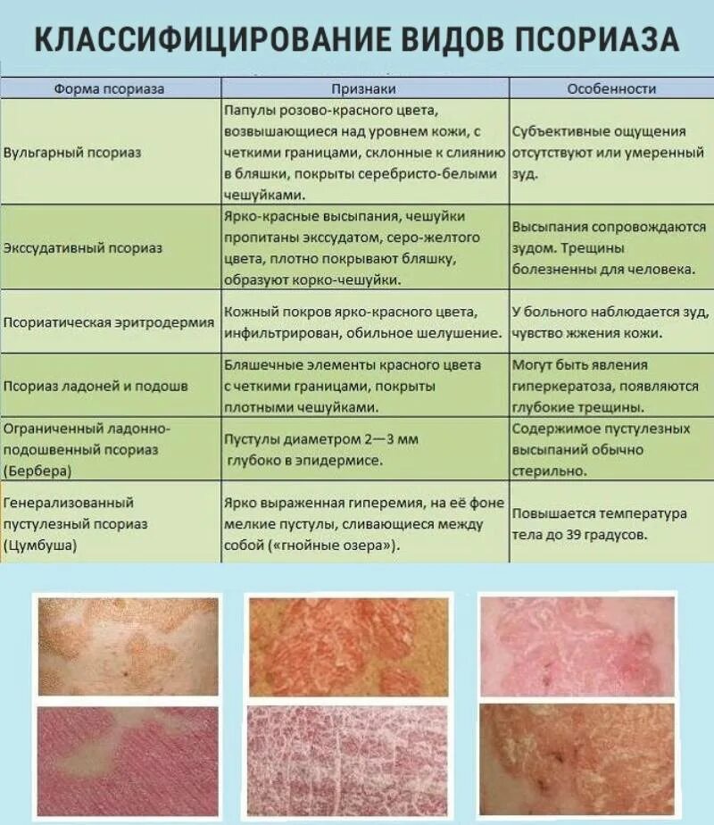 Пленочный дерматит у ребенка в паху фото Симптомы заболеваний кожи