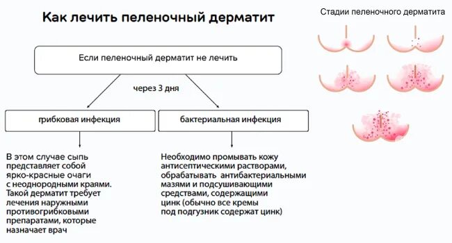 Пленочный дерматит у ребенка в паху фото Чем лечить высыпания на теле у детей