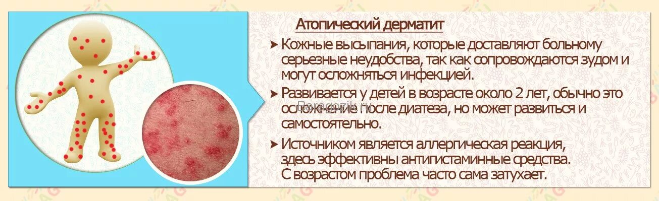 Пленочный дерматит у ребенка в паху фото Дерматит и экзема при грудном вскармливании: симптомы и лечение