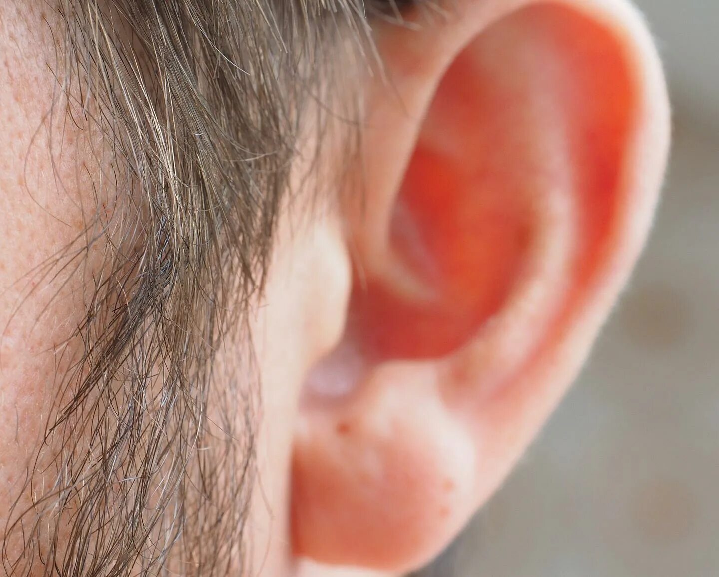 Плесень в ухе фото Sound deprivation in one ear leads to speech recognition difficulties
