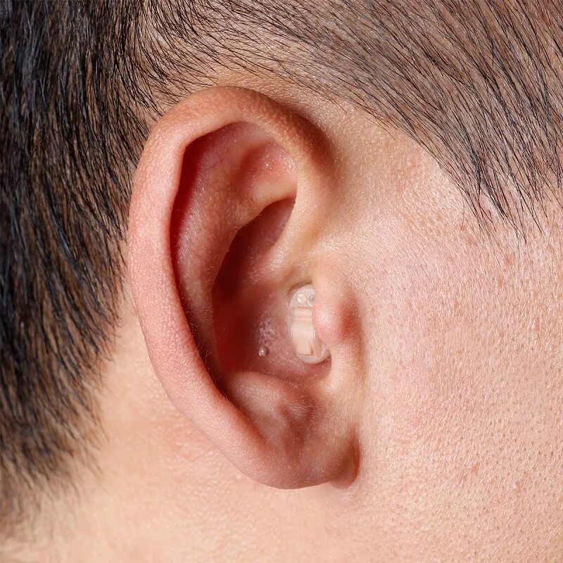 Плесень в ухе фото Слуховой аппарат AcoSound L8 IF Digital CIC невидимые слуховые усилители програм
