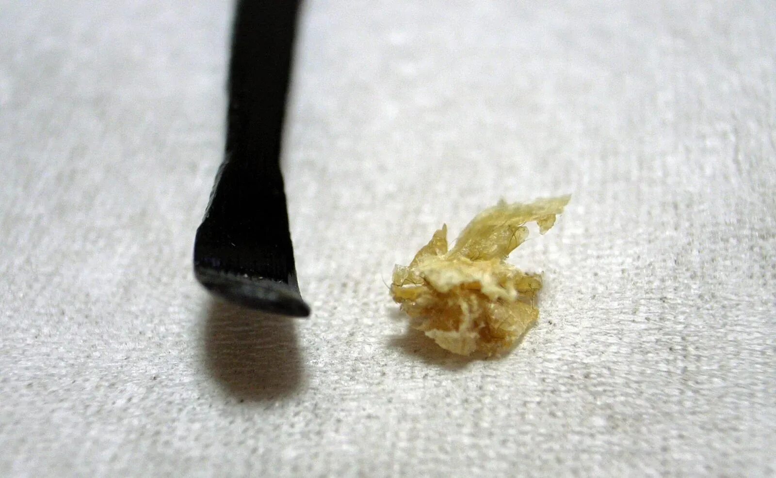 Плесень в ухе фото What Does Your Earwax Smell Like? Smithsonian